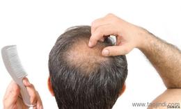 探索美发造型用品的多元世界 从价格、厂家到批发与饰品选购